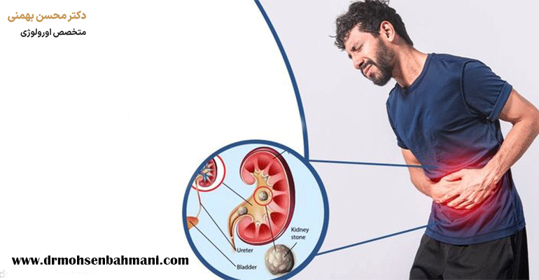 پوشش بیمه برای جراحی سنگ کلیه
