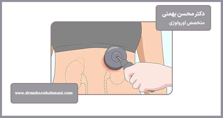پیشگیری از سنگ کلیه در آینده
