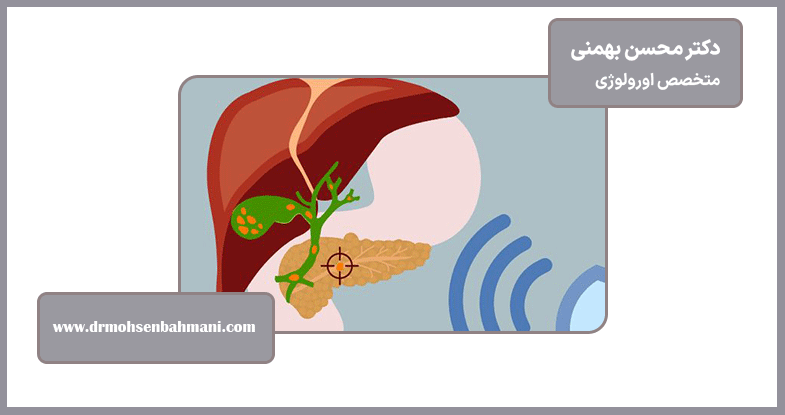 مراقبت از استنت پس از لیزر سنگ کلیه
