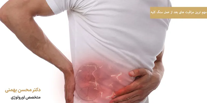 مهم ترین مراقبت های بعد از عمل سنگ کلیه