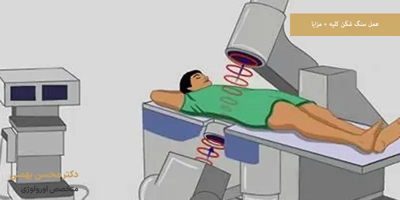 عمل سنگ شکن کلیه + مزایا