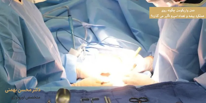 عمل واریکوسل چگونه روی عملکرد بیضه و تعداد اسپرم تأثیر می گذارد؟