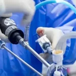 لاپاراسکوپی سنگ کلیه