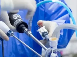 لاپاراسکوپی سنگ کلیه