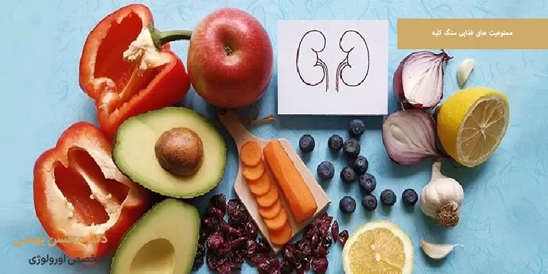  ممنوعیت های غذایی سنگ کلیه