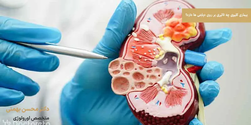 بیماری کلیوی چه تاثیری بر روی دیابتی ها دارد؟
