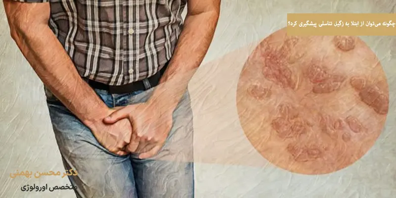 چگونه می‌توان از ابتلا به زگیل تناسلی پیشگیری کرد؟
